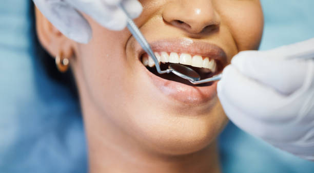 Best Emergency Gum Treatment in Defiance, OH