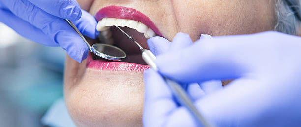 Best Emergency Treatment for Dental Infections or Abscesses in Defiance, OH